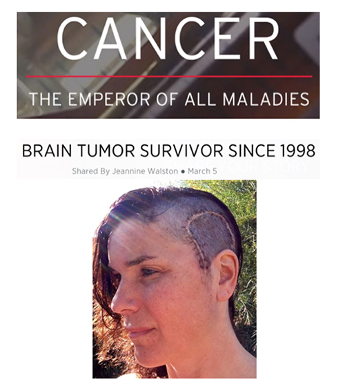 Cancer The Emporor of All Maladies images 500